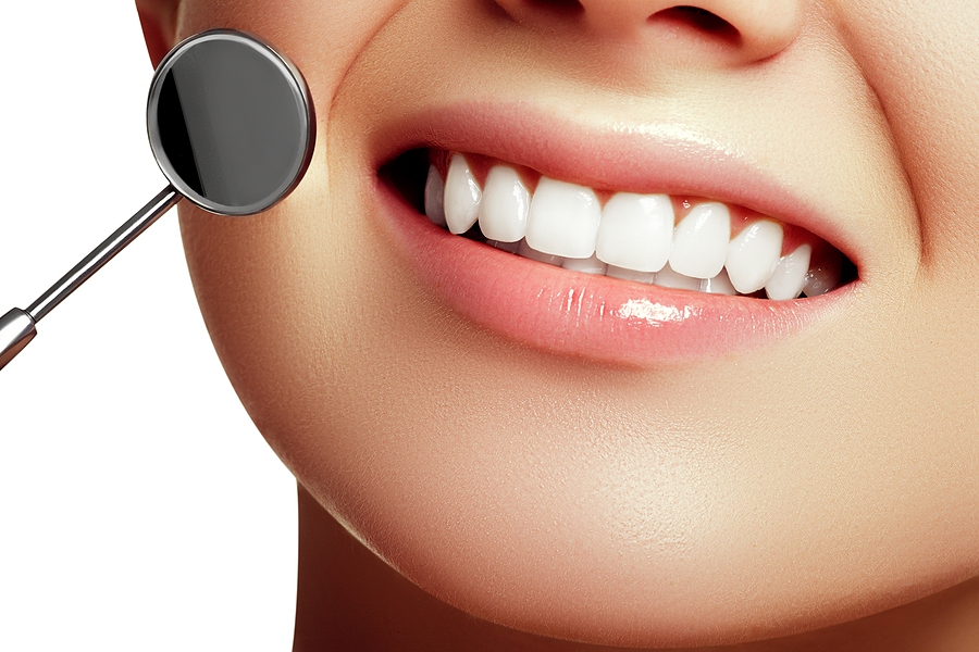 Brighten Your Smile with Professional Teeth Whitening in Sanford, FL